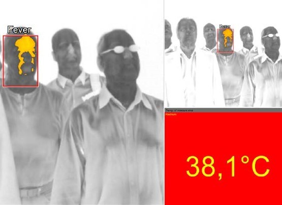 Termoscanner per temperatura corporea