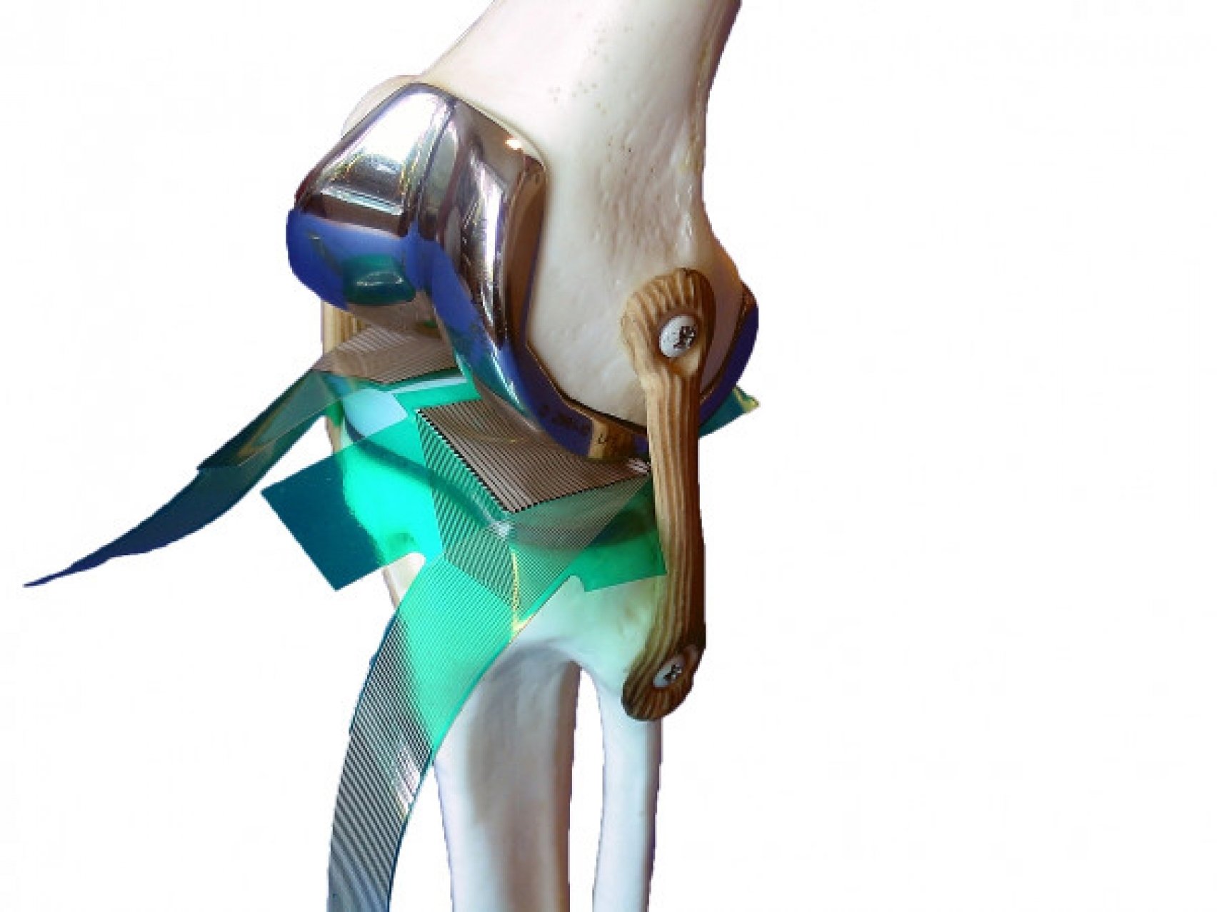 Analisi delle articolazioni